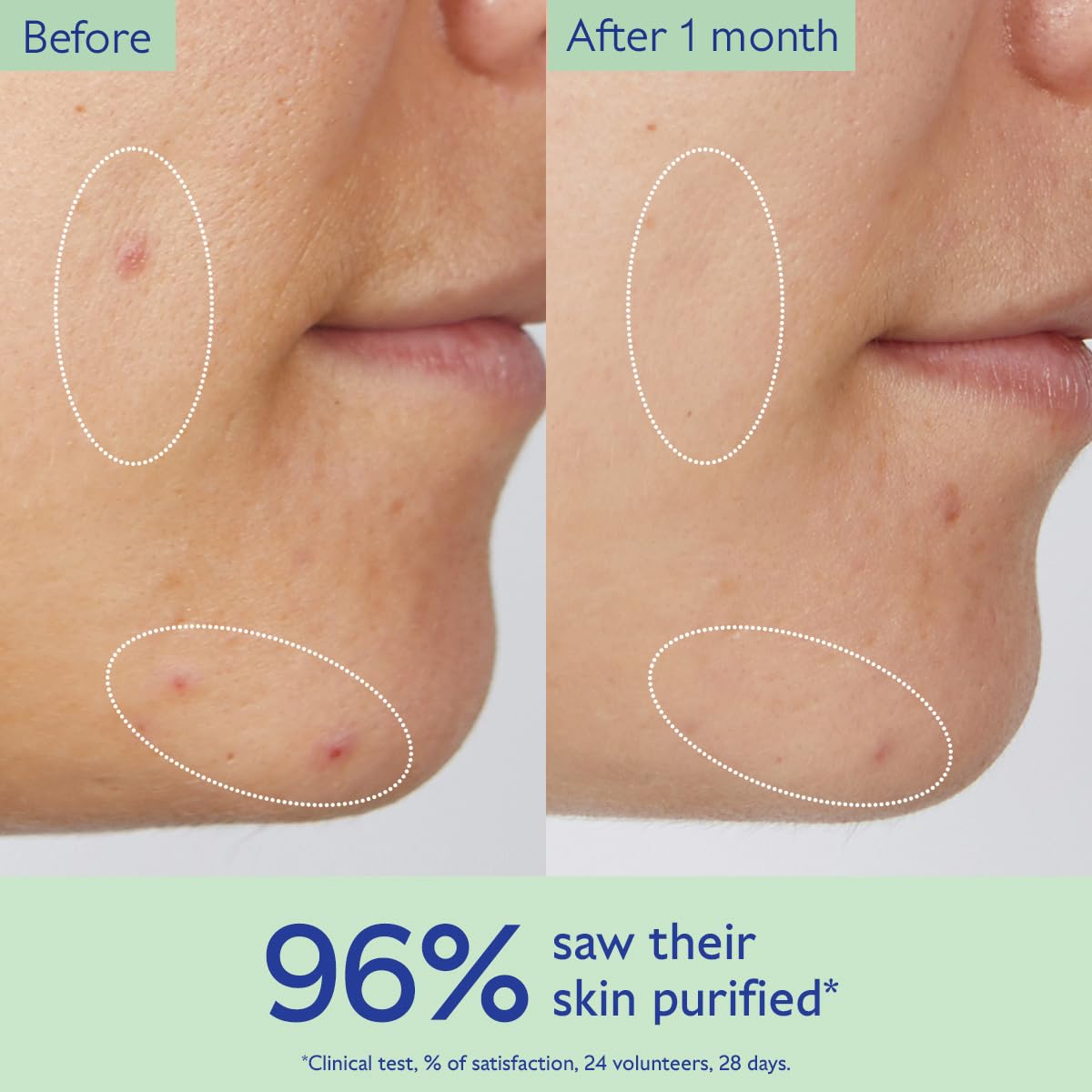 Caudalie Vinopure Salicylic Acid Cleanser - Your Ultimate Pore Purifying Gel for Clear, Radiant Skin
