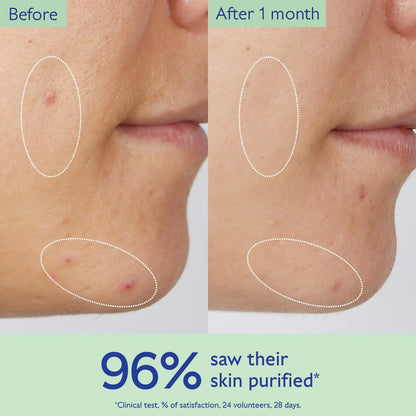 Caudalie Vinopure Salicylic Acid Cleanser - Your Ultimate Pore Purifying Gel for Clear, Radiant Skin