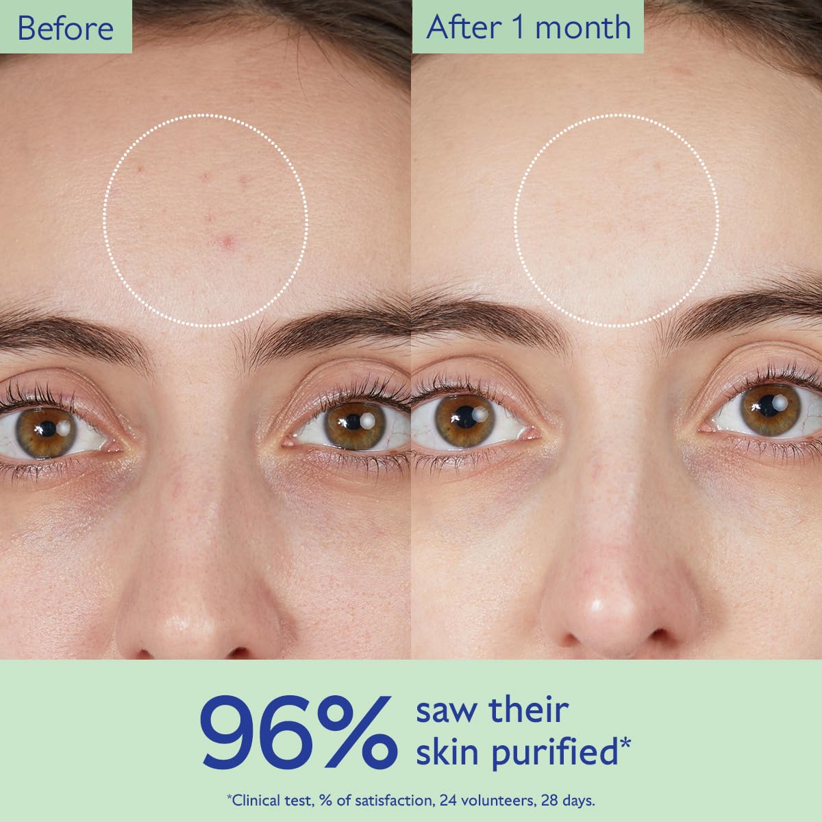Caudalie Vinopure Salicylic Acid Cleanser - Your Ultimate Pore Purifying Gel for Clear, Radiant Skin