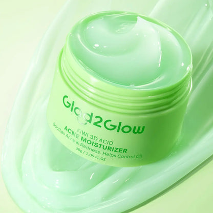 [New Launch] Glad2Glow KIWI 3D ACID ACNE MOISTURIZER | Lightweight Cooling Gel for Oil Control & Hydration | Calming Skincare, Non-Sticky Face Cream