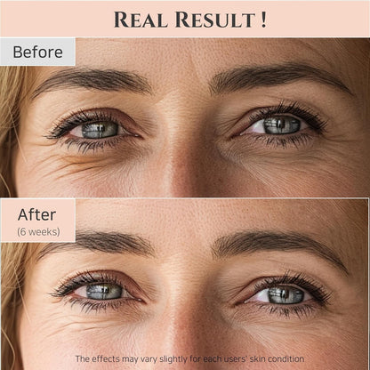 Beauty of Joseon Revive Eye Serum with Retinal Niacinamide Correction (02/27/27)